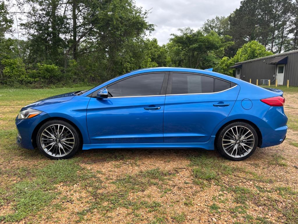 2017 Hyundai Elantra 1.6 Sport A/T's photo